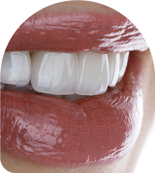 Porcelain Veneers Dromana